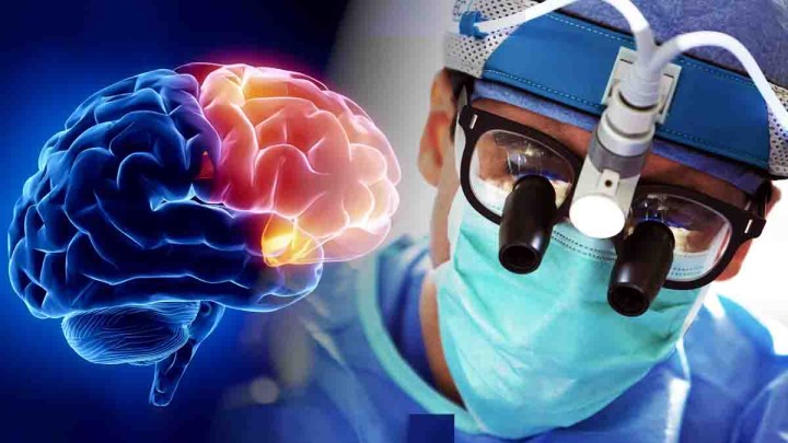 بیوپسی مغزی برای تشخیص آمیب مغزحوار