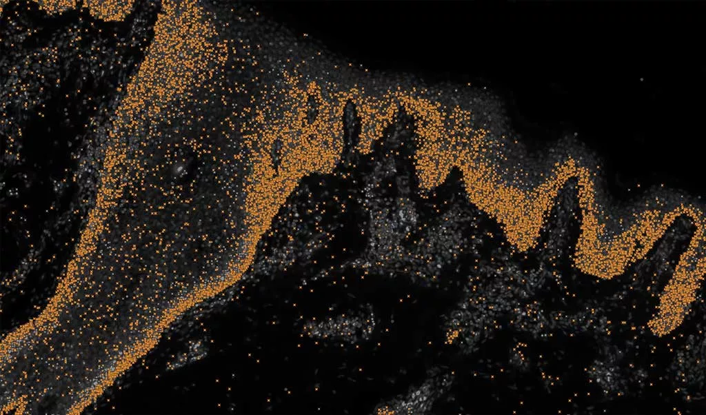 1729417745 221 پژوهشی تازه در حوزه پوست می‌تواند به افت شدت علائم.webp